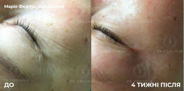 By Dr. Soumiya Djebbar, UK (2)