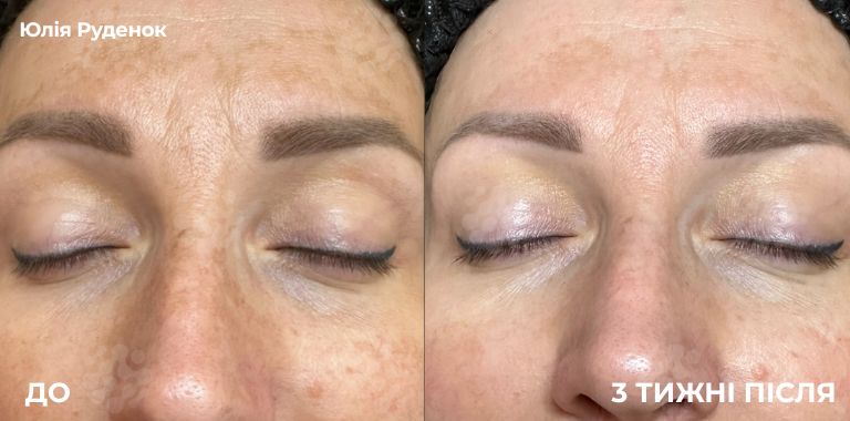 By Dr. Soumiya Djebbar, UK (4)