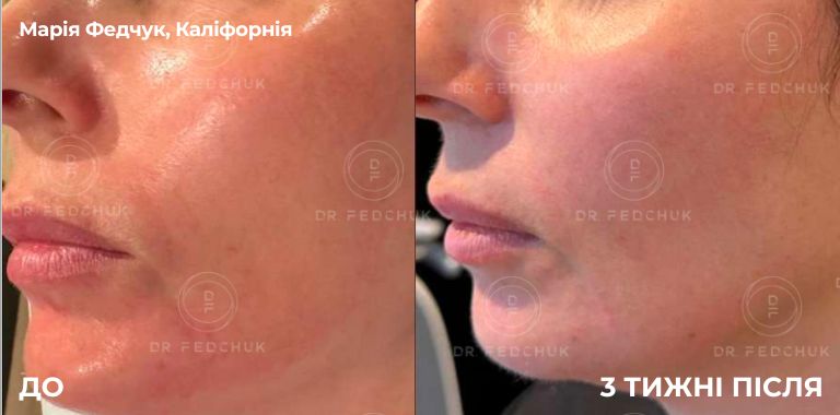 By Dr. Soumiya Djebbar, UK